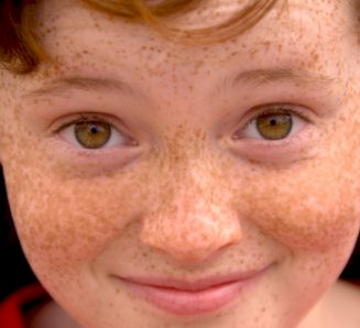 Babies With Freckles